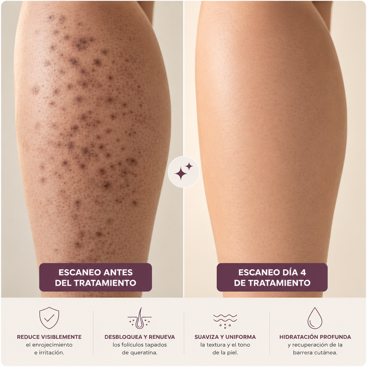 GLOVA™ — Crema Corporal para Suavizar la Textura Rugosa y los Puntitos Rojos
