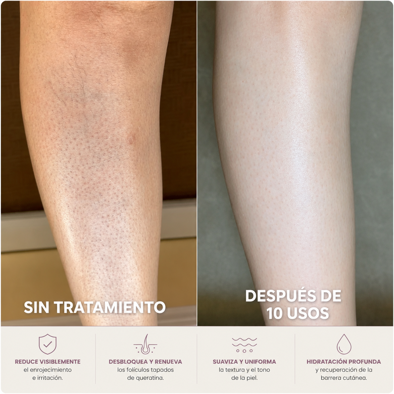 GLOVA™ — Crema Corporal para Suavizar la Textura Rugosa y los Puntitos Rojos