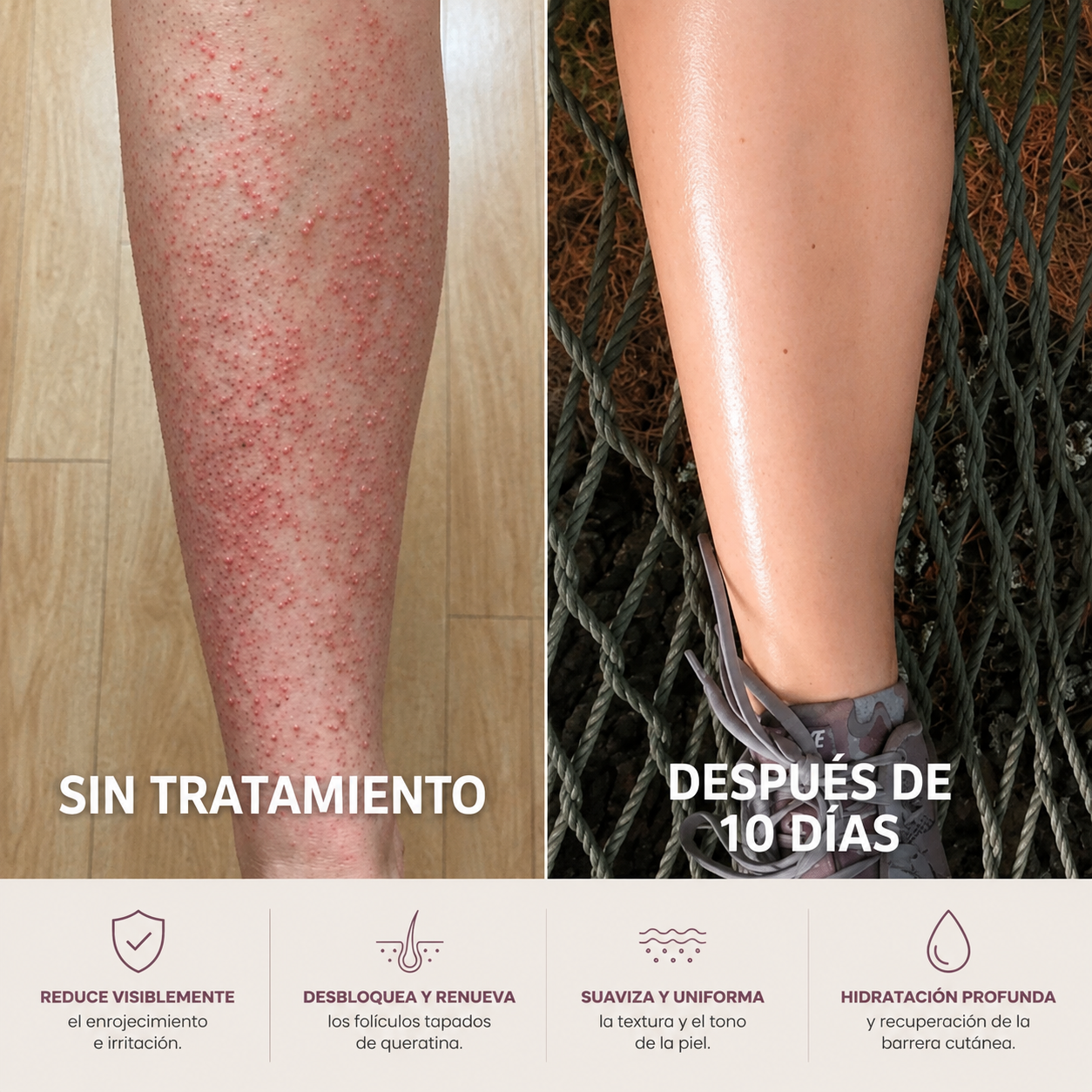 GLOVA™ — Crema Corporal para Suavizar la Textura Rugosa y los Puntitos Rojos